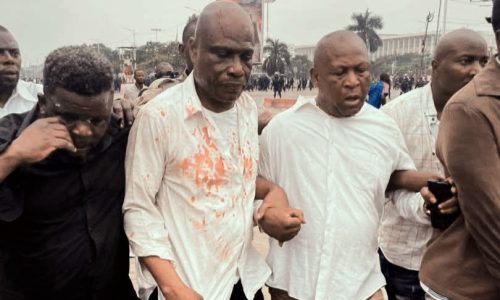 HRW dénonce « l&rsquo;usage excessif de la force » le 12 juin à Kinshasa